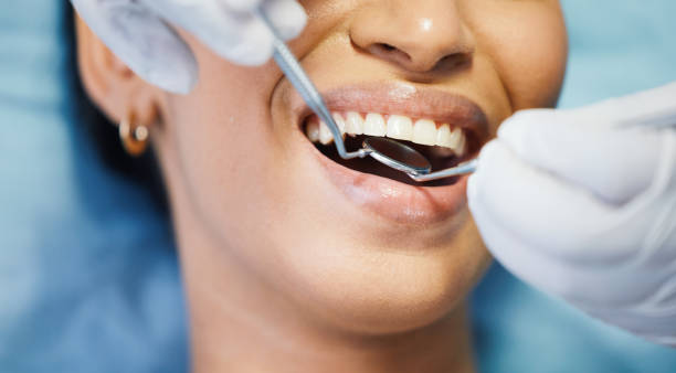Best Emergency Treatment for Dental Infections or Abscesses in Mount Zion, GA