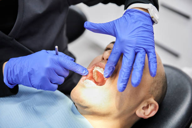 Best Emergency Treatment for Dental Infections or Abscesses in Mount Zion, GA